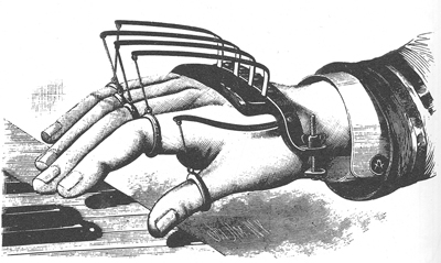Docâs wearing something based on a Victorian invention intended to give support to the fingers of typists and pianists. If you look closely at this illustration, thereâs what appears to be a masonic symbol on the shirt button.